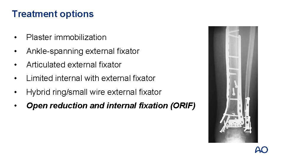 Treatment options • Plaster immobilization • Ankle-spanning external fixator • Articulated external fixator •