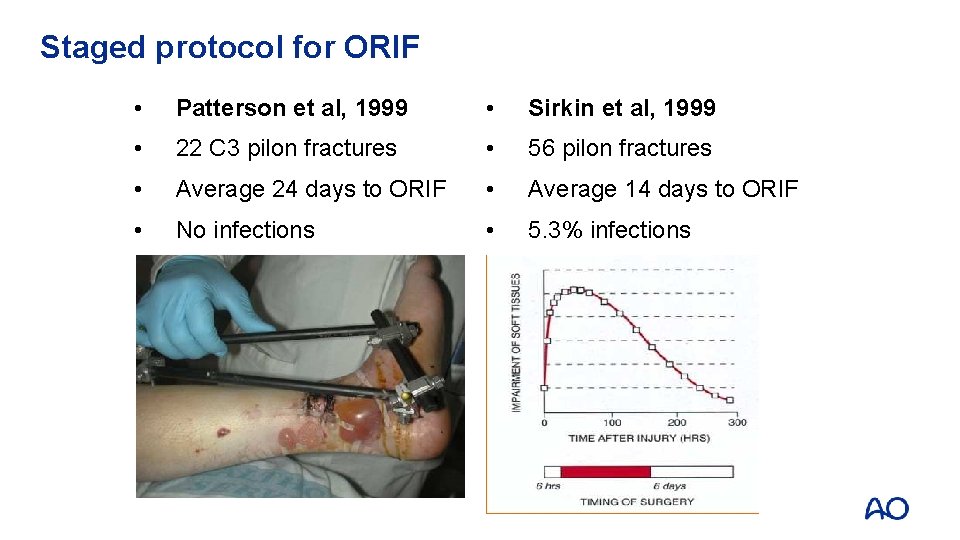Staged protocol for ORIF • Patterson et al, 1999 • Sirkin et al, 1999