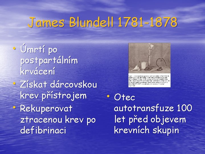 James Blundell 1781 -1878 • Úmrtí po • • postpartálním krvácení Získat dárcovskou krev