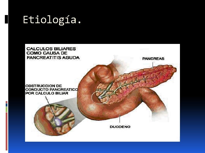 Etiología. 