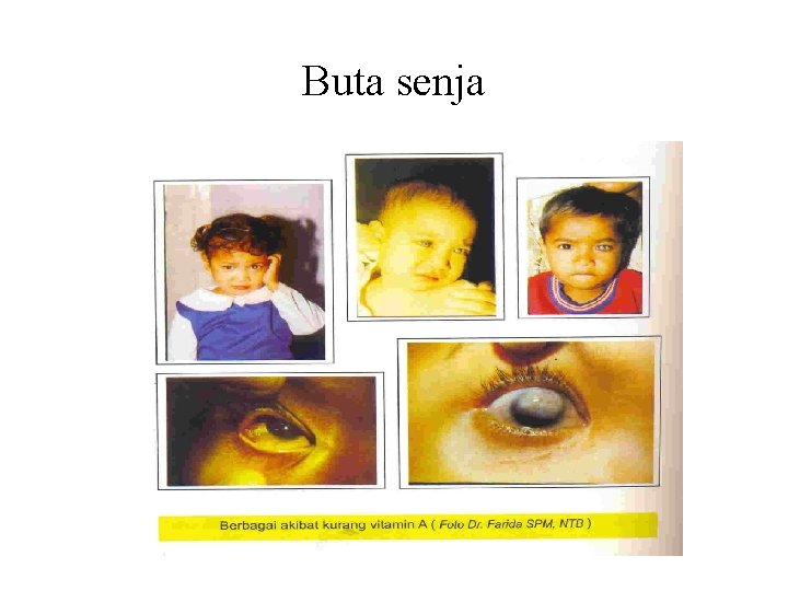 Buta senja 