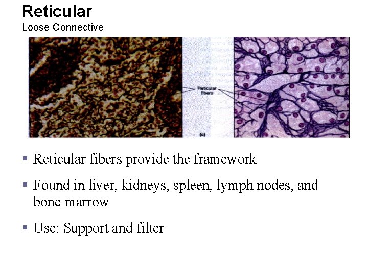 Reticular Loose Connective § Reticular fibers provide the framework § Found in liver, kidneys,