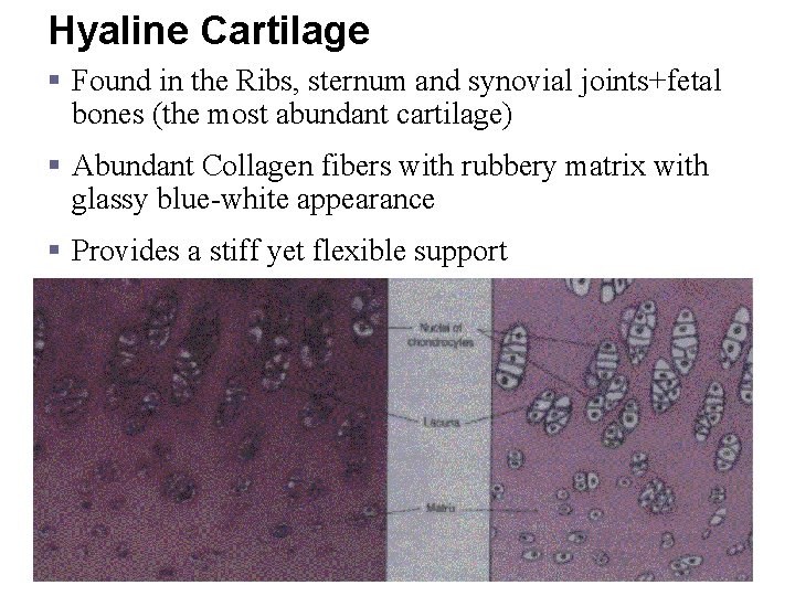 Hyaline Cartilage § Found in the Ribs, sternum and synovial joints+fetal bones (the most