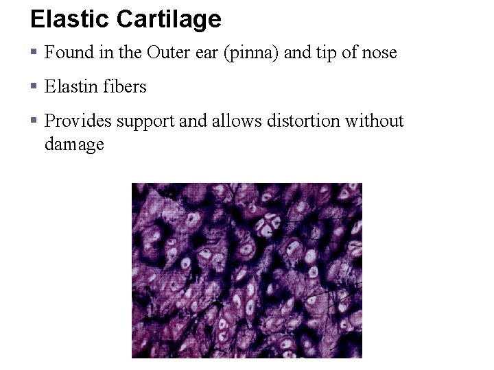 Elastic Cartilage § Found in the Outer ear (pinna) and tip of nose §