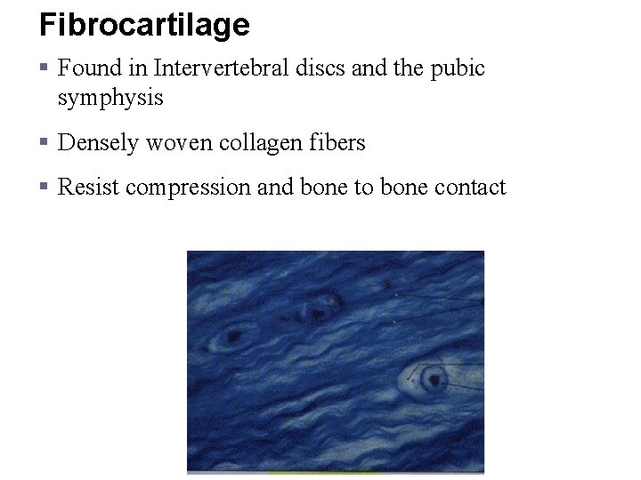 Fibrocartilage § Found in Intervertebral discs and the pubic symphysis § Densely woven collagen