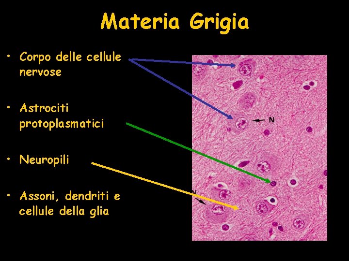 Materia Grigia • Corpo delle cellule nervose • Astrociti protoplasmatici • Neuropili • Assoni,