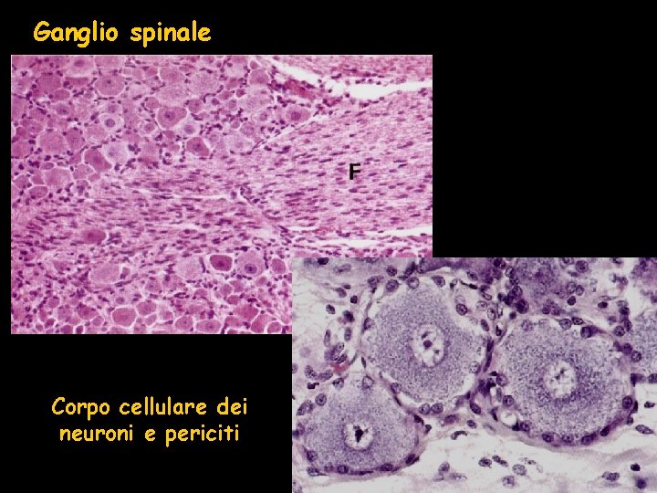 Ganglio spinale Corpo cellulare dei neuroni e periciti 