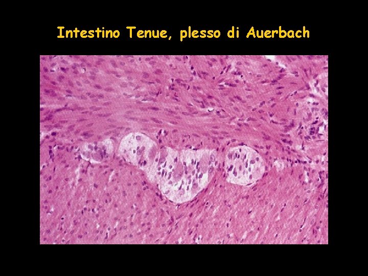 Intestino Tenue, plesso di Auerbach 