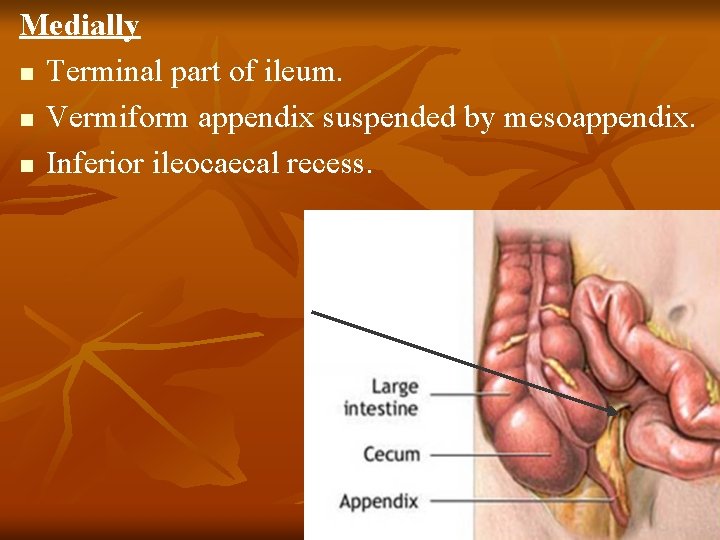 Medially n Terminal part of ileum. n Vermiform appendix suspended by mesoappendix. n Inferior