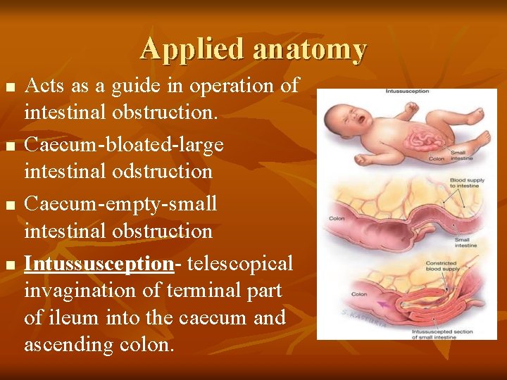 Applied anatomy n n Acts as a guide in operation of intestinal obstruction. Caecum-bloated-large