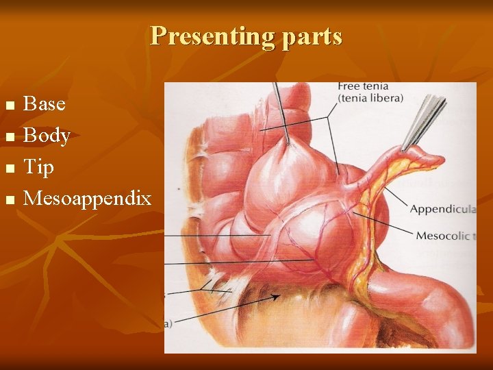 Presenting parts n n Base Body Tip Mesoappendix 