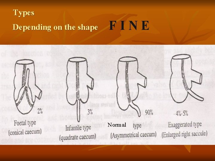 Types Depending on the shape FINE Normal 