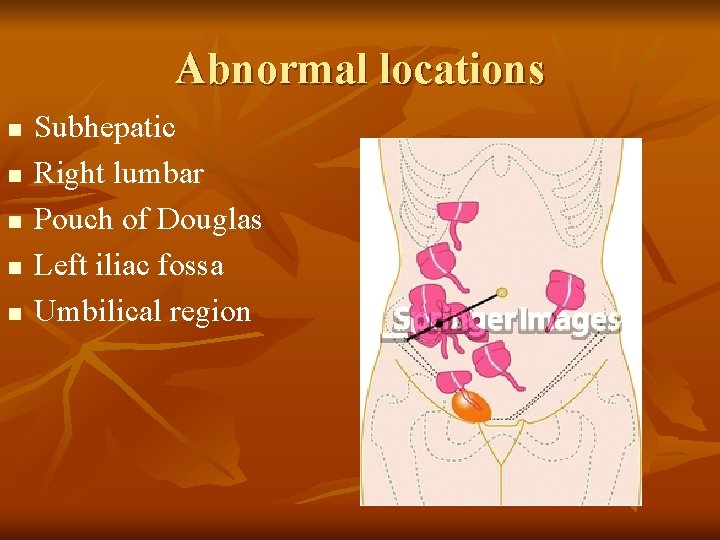 Abnormal locations n n n Subhepatic Right lumbar Pouch of Douglas Left iliac fossa