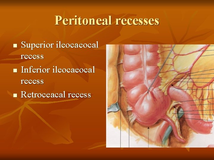 Peritoneal recesses n n n Superior ileocal recess Inferior ileocal recess Retroceacal recess 