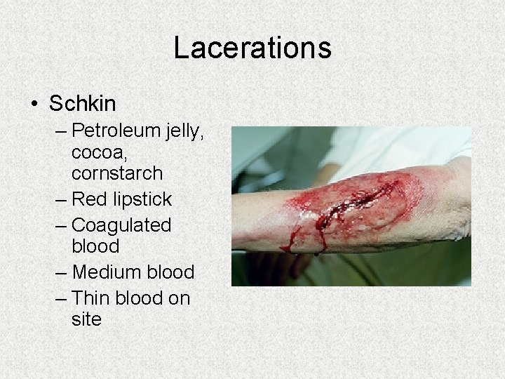 Lacerations • Schkin – Petroleum jelly, cocoa, cornstarch – Red lipstick – Coagulated blood Lacerations • Schkin – Petroleum jelly, cocoa, cornstarch – Red lipstick – Coagulated blood