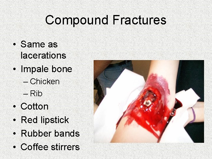 Compound Fractures • Same as lacerations • Impale bone – Chicken – Rib • Compound Fractures • Same as lacerations • Impale bone – Chicken – Rib •