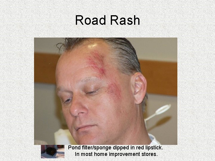 Road Rash Pond filter/sponge dipped in red lipstick. In most home improvement stores. Road Rash Pond filter/sponge dipped in red lipstick. In most home improvement stores.