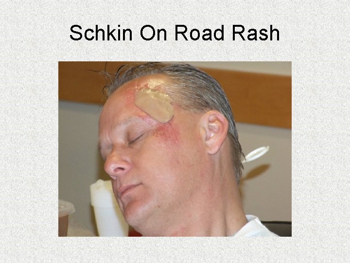 Schkin On Road Rash Schkin On Road Rash