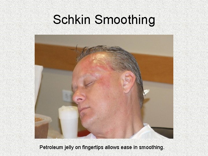 Schkin Smoothing Petroleum jelly on fingertips allows ease in smoothing. Schkin Smoothing Petroleum jelly on fingertips allows ease in smoothing.