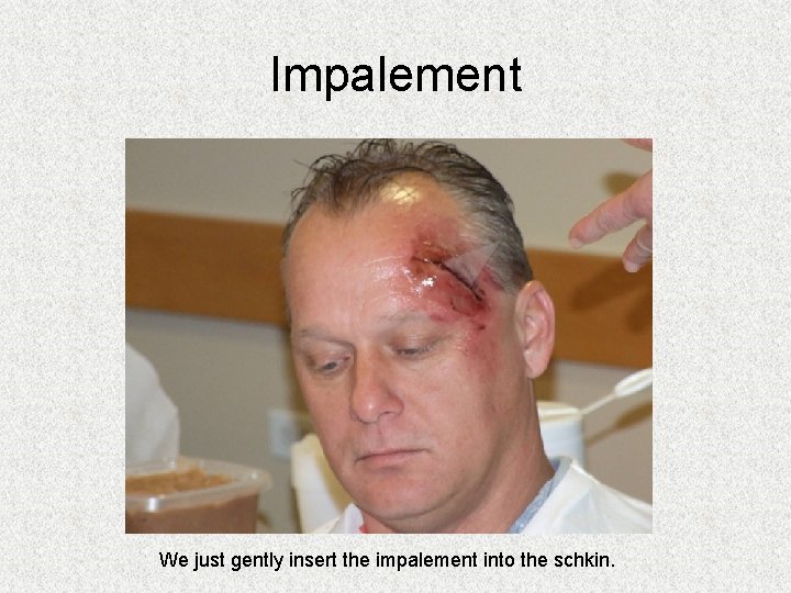Impalement We just gently insert the impalement into the schkin. Impalement We just gently insert the impalement into the schkin.