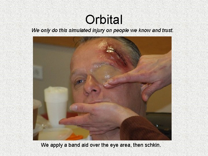 Orbital We only do this simulated injury on people we know and trust. We Orbital We only do this simulated injury on people we know and trust. We