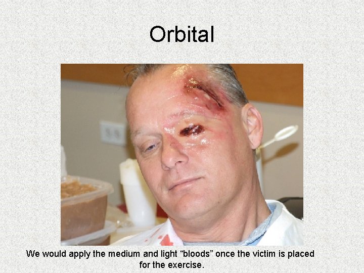 Orbital We would apply the medium and light “bloods” once the victim is placed Orbital We would apply the medium and light “bloods” once the victim is placed