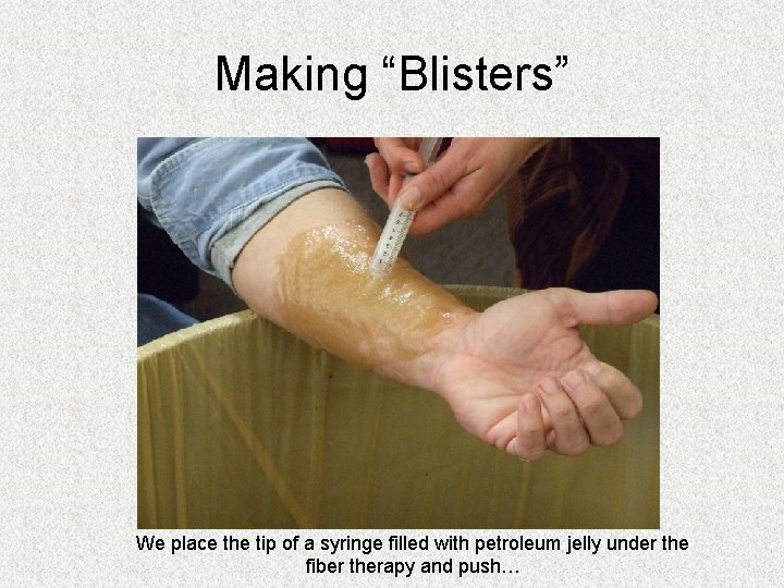 Making “Blisters” We place the tip of a syringe filled with petroleum jelly under Making “Blisters” We place the tip of a syringe filled with petroleum jelly under