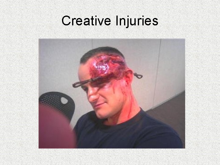 Creative Injuries Creative Injuries
