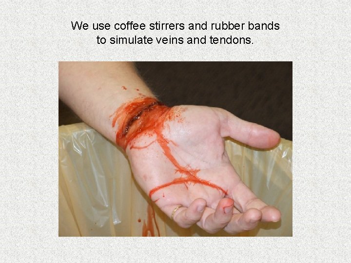 We use coffee stirrers and rubber bands to simulate veins and tendons. We use coffee stirrers and rubber bands to simulate veins and tendons.