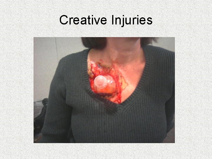 Creative Injuries Creative Injuries