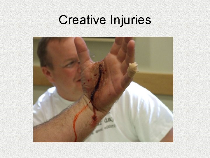 Creative Injuries Creative Injuries
