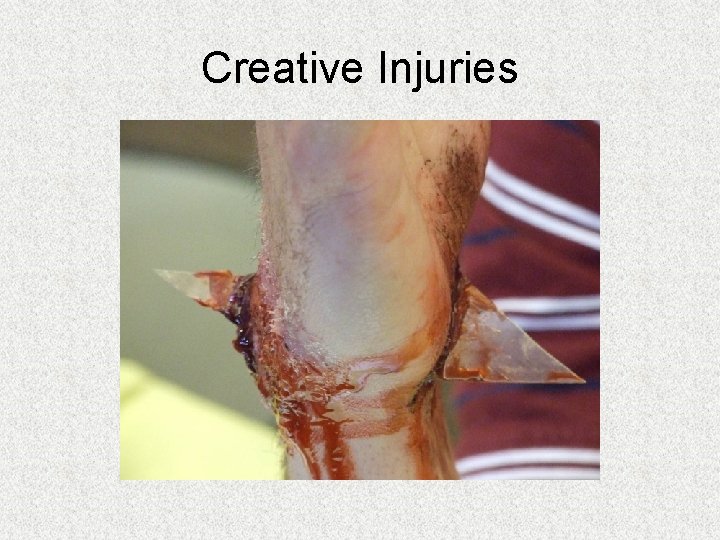 Creative Injuries Creative Injuries