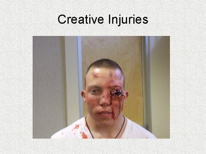 Creative Injuries Creative Injuries