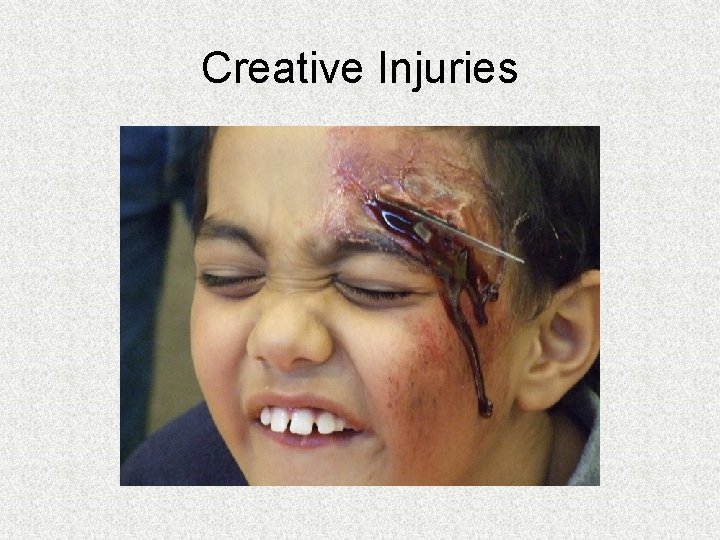 Creative Injuries Creative Injuries