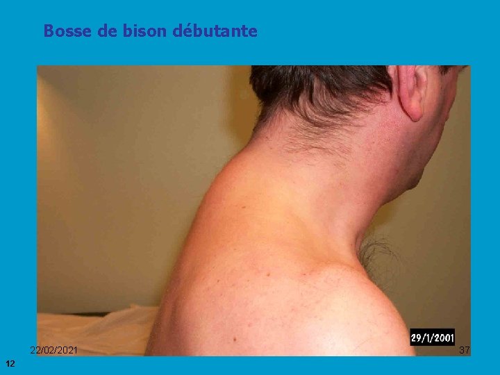 Bosse de bison débutante 22/02/2021 12 37 