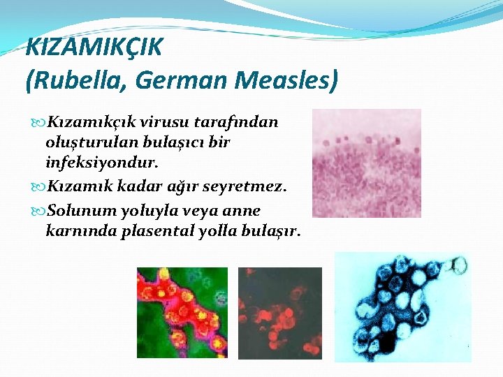 KIZAMIKÇIK (Rubella, German Measles) Kızamıkçık virusu tarafından oluşturulan bulaşıcı bir infeksiyondur. Kızamık kadar ağır