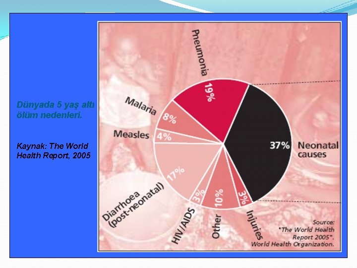 Dünyada 5 yaş altı ölüm nedenleri. Kaynak: The World Health Report, 2005 