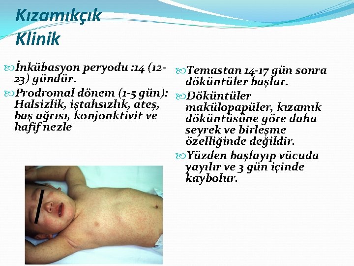 Kızamıkçık Klinik İnkübasyon peryodu : 14 (12 - Temastan 14 -17 gün sonra 23)