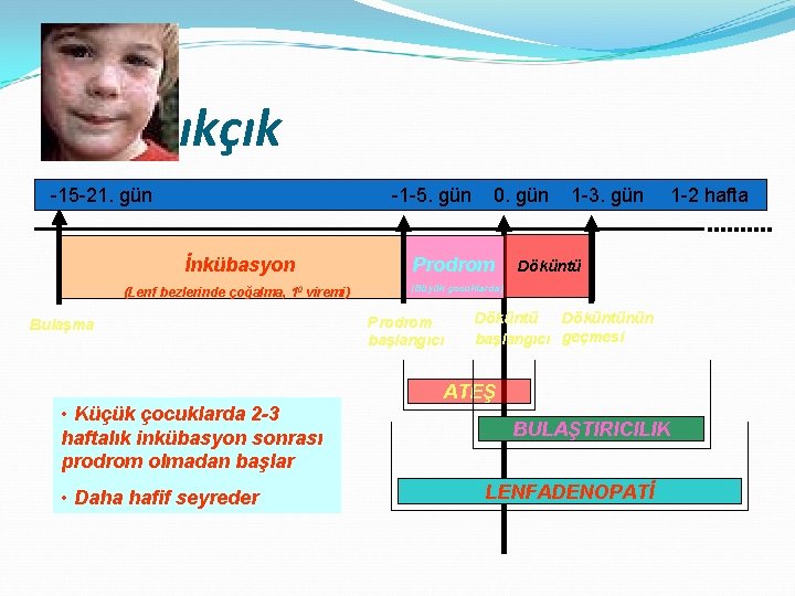 Kızamıkçık -15 -21. gün -1 -5. gün İnkübasyon (Lenf bezlerinde çoğalma, 10 viremi) Bulaşma