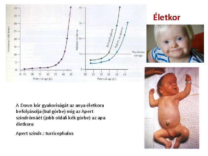Életkor A Down kór gyakoriságát az anya életkora befolyásolja (bal görbe) míg az Apert Életkor A Down kór gyakoriságát az anya életkora befolyásolja (bal görbe) míg az Apert