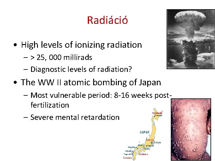 Radiáció • High levels of ionizing radiation – > 25, 000 millirads – Diagnostic