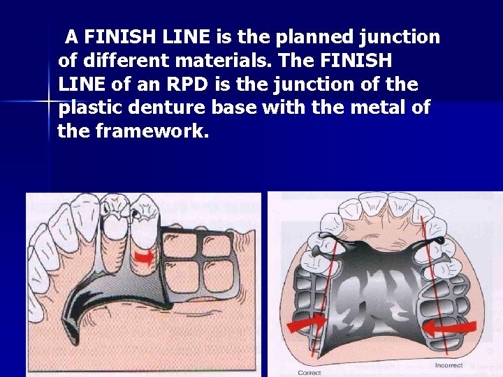 A FINISH LINE is the planned junction of different materials. The FINISH LINE of