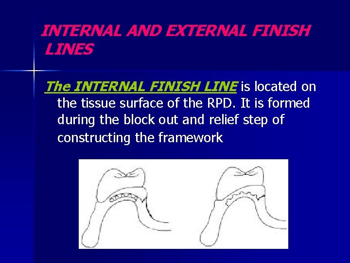 INTERNAL AND EXTERNAL FINISH LINES The INTERNAL FINISH LINE is located on the tissue