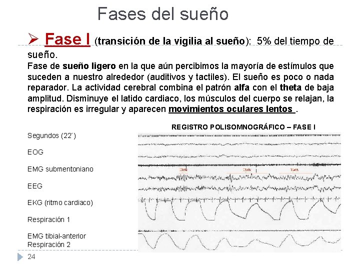 Fases del sueño Ø Fase I (transición de la vigilia al sueño): 5% del Fases del sueño Ø Fase I (transición de la vigilia al sueño): 5% del