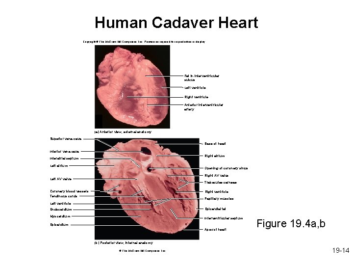 Human Cadaver Heart Copyright © The Mc. Graw-Hill Companies, Inc. Permission required for reproduction