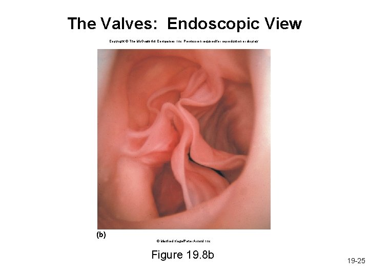 The Valves: Endoscopic View Copyright © The Mc. Graw-Hill Companies, Inc. Permission required for