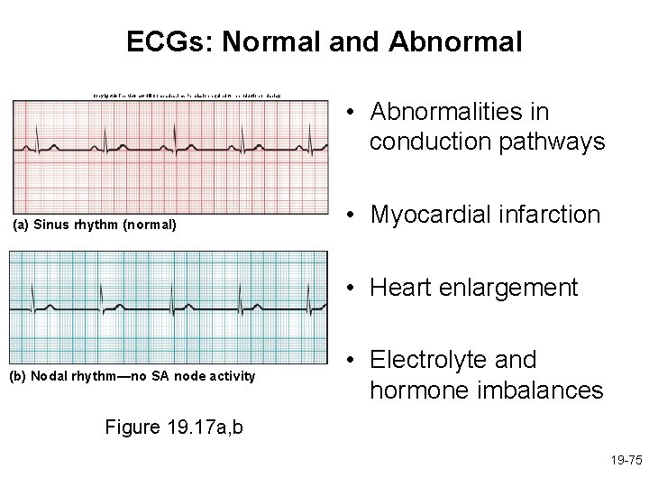 ECGs: Normal and Abnormal Copyright © The Mc. Graw-Hill Companies, Inc. Permission required for