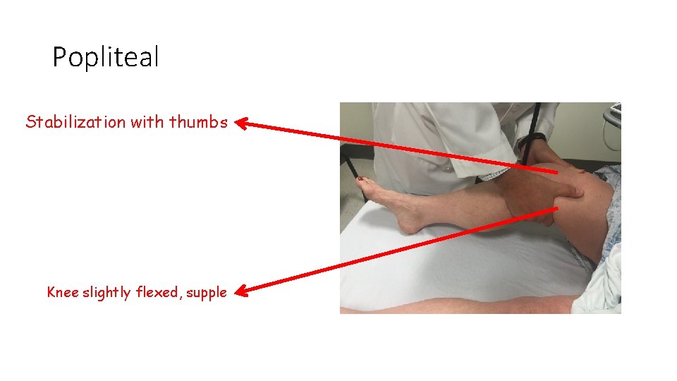 Popliteal Stabilization with thumbs Knee slightly flexed, supple Popliteal Stabilization with thumbs Knee slightly flexed, supple