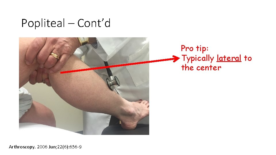 Popliteal – Cont’d Pro tip: Typically lateral to the center Arthroscopy. 2006 Jun; 22(6): Popliteal – Cont’d Pro tip: Typically lateral to the center Arthroscopy. 2006 Jun; 22(6):