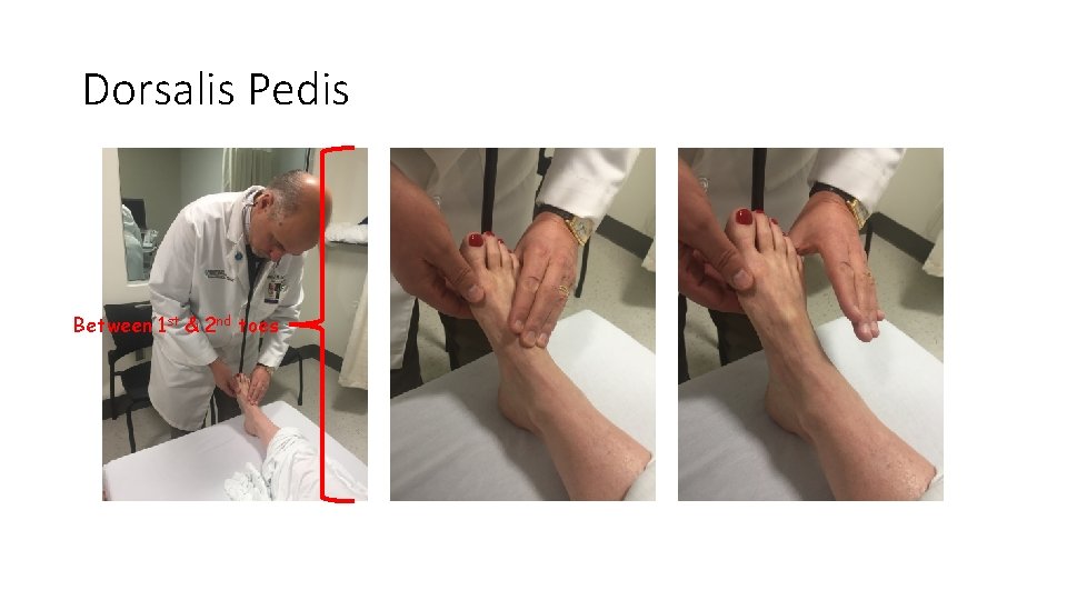 Dorsalis Pedis Between 1 st & 2 nd toes Dorsalis Pedis Between 1 st & 2 nd toes